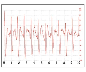 A pulse signal.