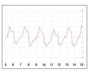 The response of the piezo sensor.