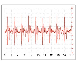 Filters applied to chest wall signal.